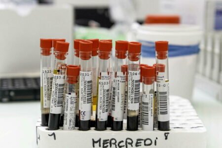 This curious illness that impacts 200 individuals worldwide
 | EUROtoday