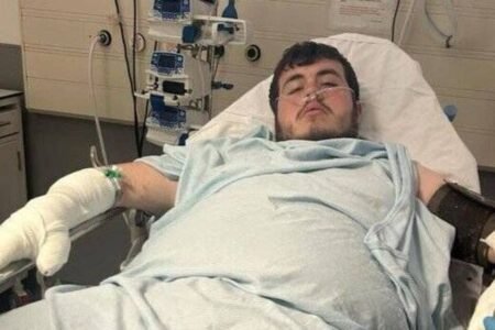 Hero bystander significantly injured saving mum and child from canine assault | UK | News
 | EUROtoday